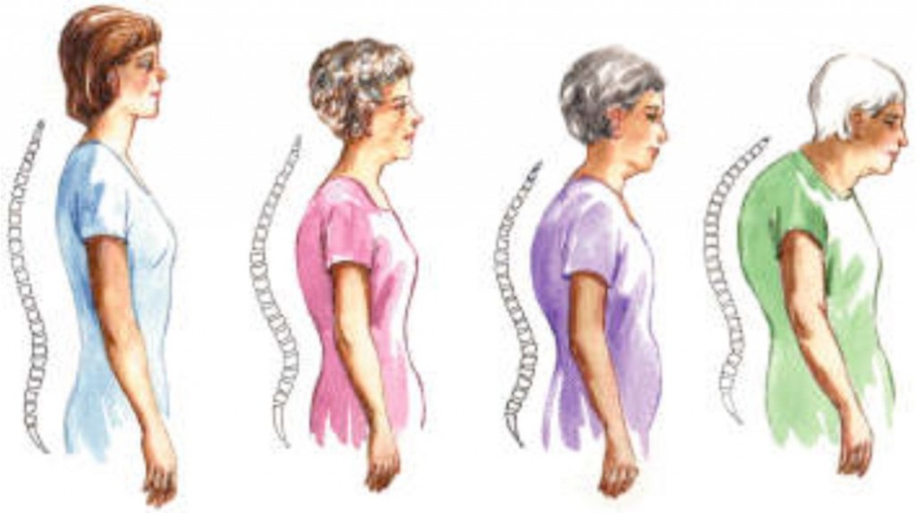 ladies curved spine1 1024x574